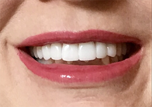 After